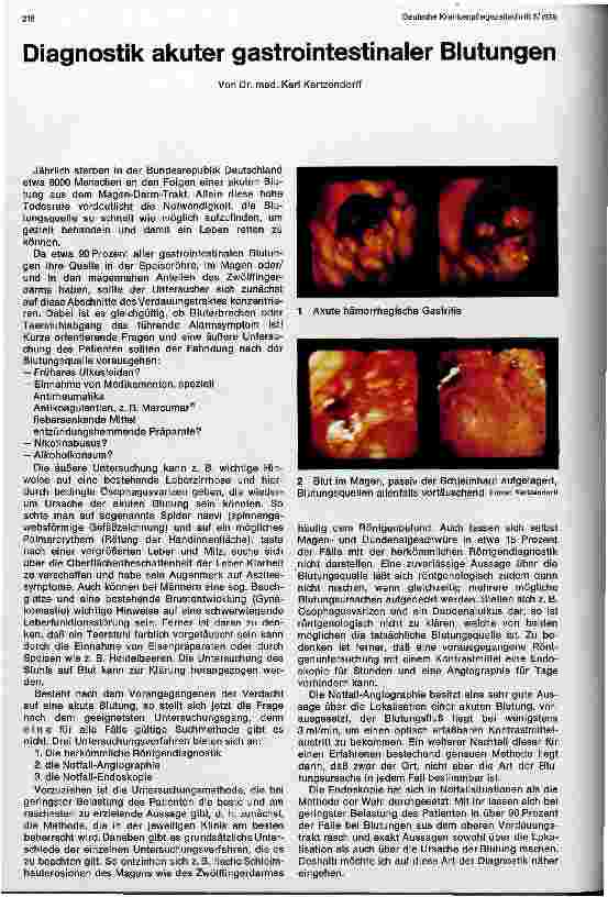 Vorschauseite 1: Diagnostik akuter gastrointestinaler Blutungen
