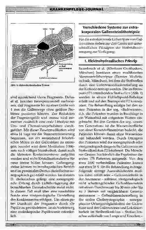 Vorschauseite 2: Ergebnisse der Extrakorporalen Lithotripsie von Gallensteinen