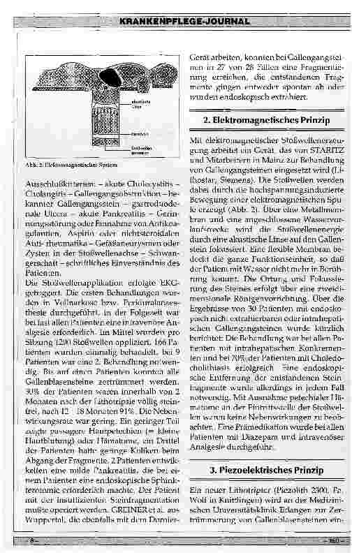 Vorschauseite 3: Ergebnisse der Extrakorporalen Lithotripsie von Gallensteinen