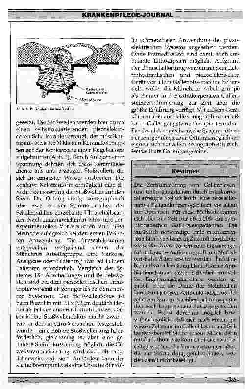 Vorschauseite 5: Ergebnisse der Extrakorporalen Lithotripsie von Gallensteinen