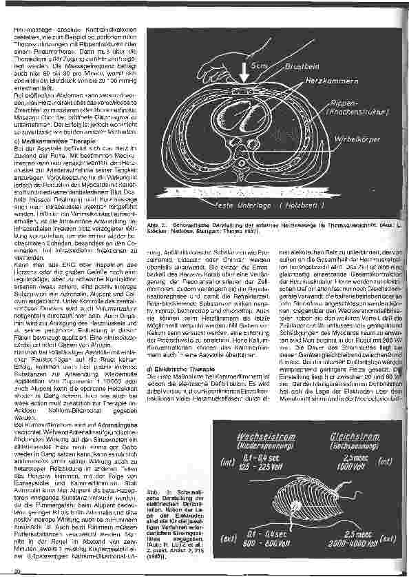 Vorschauseite 2: Aktuelle Themen aus Intensivmedizin und Anästhesiologie 12. Folge: Herz-Kreislauf-Stillstand während der Narkose