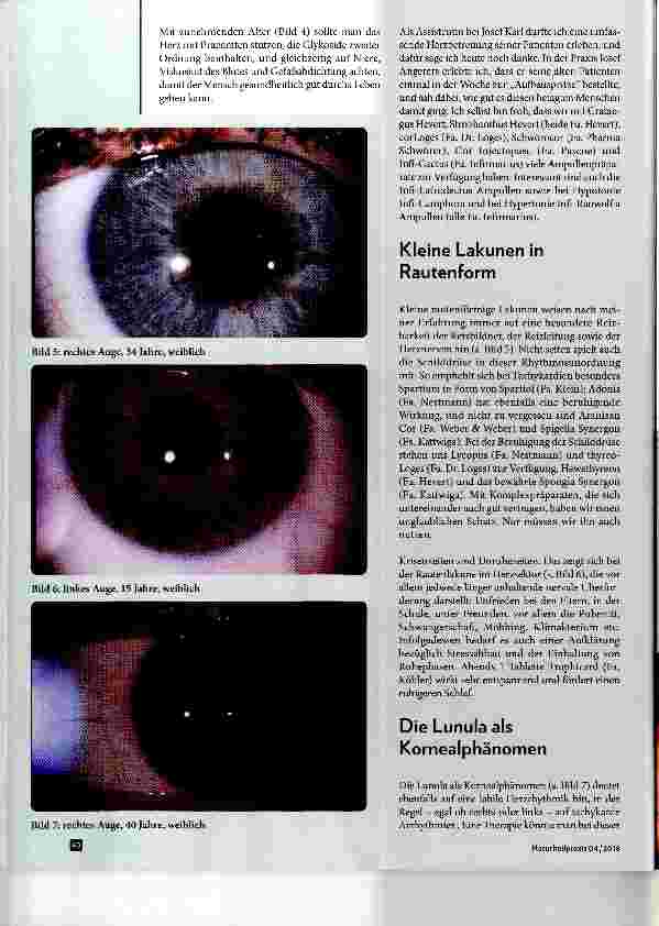 Vorschauseite 3: Herzzeichen aus der Sicht der Augendiagnose