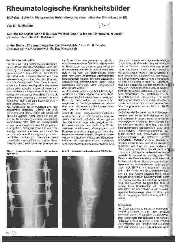 Vorschauseite 1: Rheumatologische Krankheitsbilder 10. Folge (Schluß) Die operative Behandlung der rheumatischen Erkrankungen
