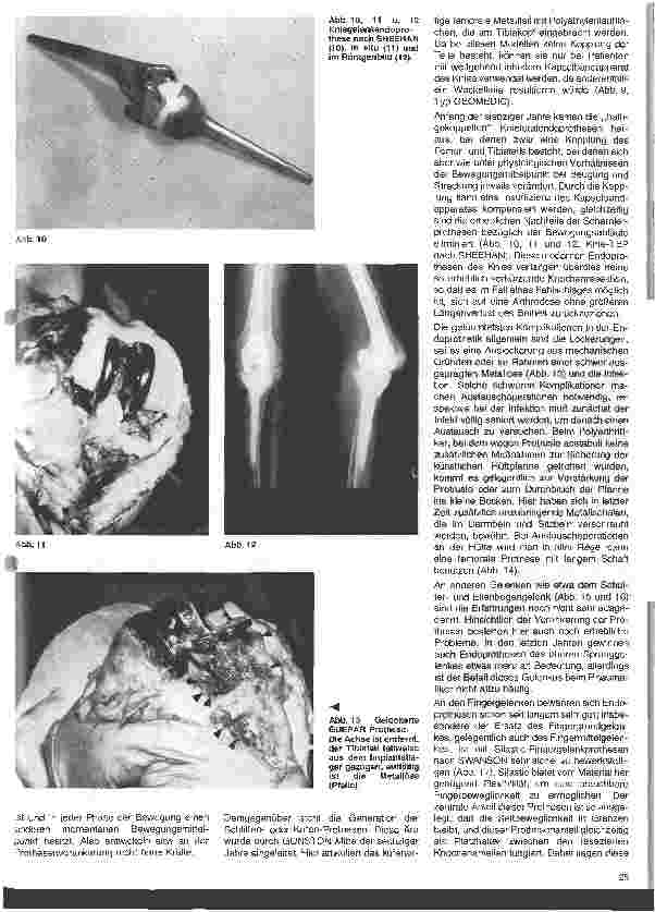 Vorschauseite 5: Rheumatologische Krankheitsbilder 10. Folge (Schluß) Die operative Behandlung der rheumatischen Erkrankungen
