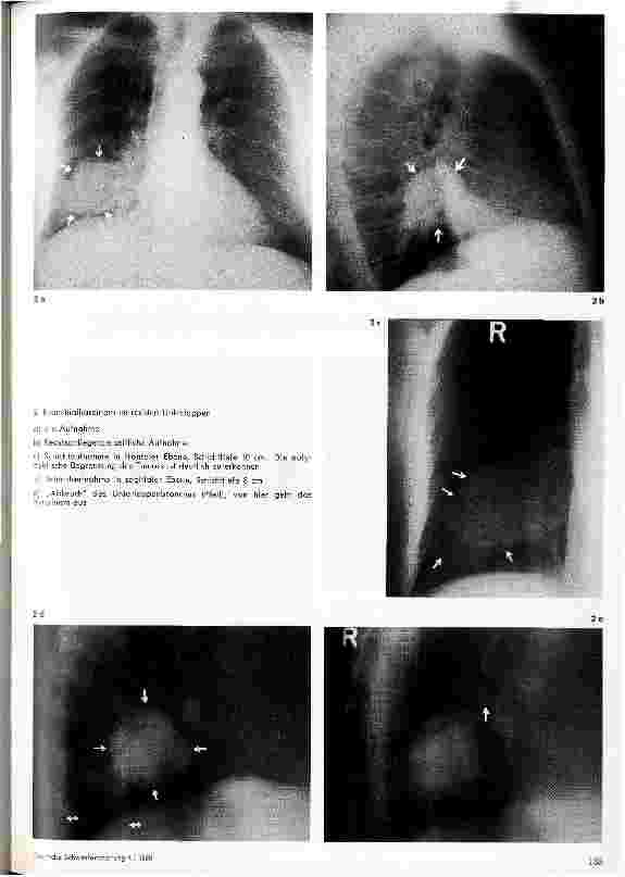 Vorschauseite 2: Röntgendemonstration 3. Folge: Das Schichtaufnahmeverfahren: Tomographie, Planigraphie