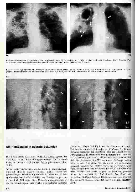 Vorschauseite 3: Röntgendemonstration 3. Folge: Das Schichtaufnahmeverfahren: Tomographie, Planigraphie