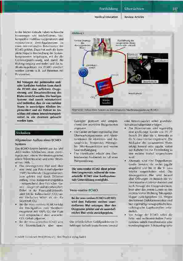 Vorschauseite 2: Extrakorporale Membranoxygenierung