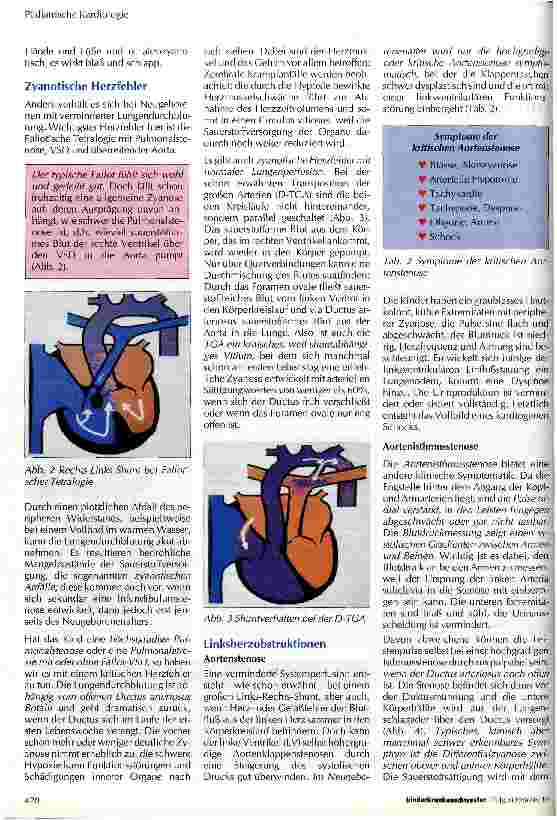 Vorschauseite 2: Klinisches Bild und konservative Therapie bei Neugeborenen mit kongenitalen Herzfehlern