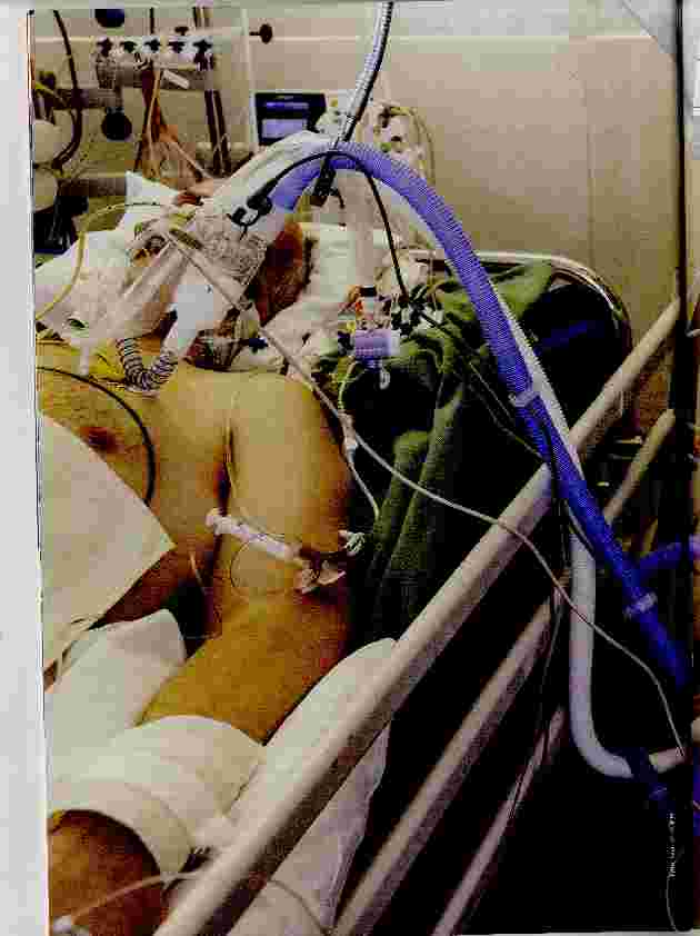 Vorschauseite 1: Sepsis: Lebensbedrohliches Krankheitsbild mit hoher Mortalität