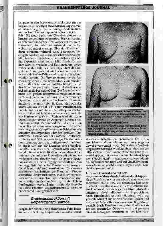 Vorschauseite 2: Möglichkeiten der plastischen Chirurgie zur Rekonstruktion der Mamma nach Karzinomenentfernung