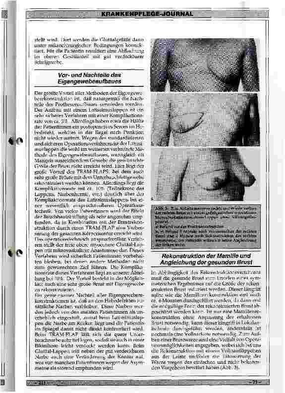 Vorschauseite 4: Möglichkeiten der plastischen Chirurgie zur Rekonstruktion der Mamma nach Karzinomenentfernung