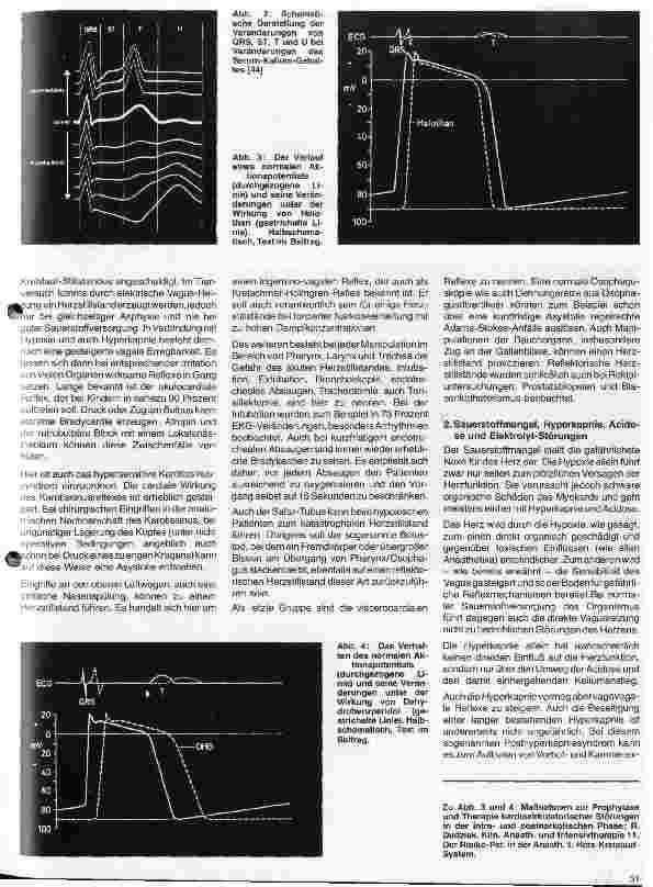 Vorschauseite 2: Aktuelle Themen aus Intensivmedizin und Anästhesiologie 11 Folge: Herz-Kreislauf-Stillstand während der Narkose
