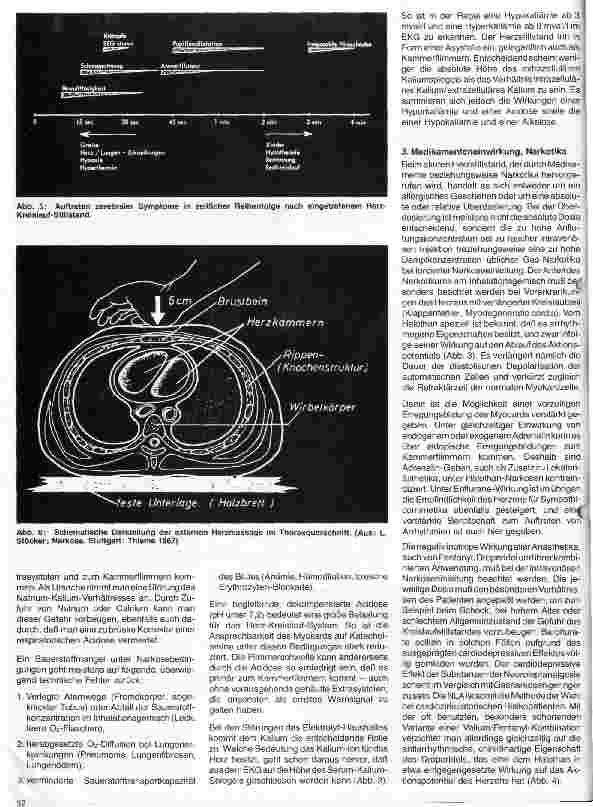 Vorschauseite 3: Aktuelle Themen aus Intensivmedizin und Anästhesiologie 11 Folge: Herz-Kreislauf-Stillstand während der Narkose
