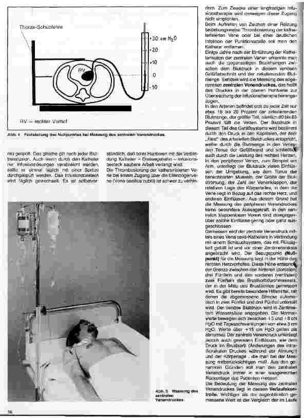 Vorschauseite 3: Intensivpflege-Intensivbehandlung 5. Folge: Venenkatheter - Messung des zentralen Venendruckes