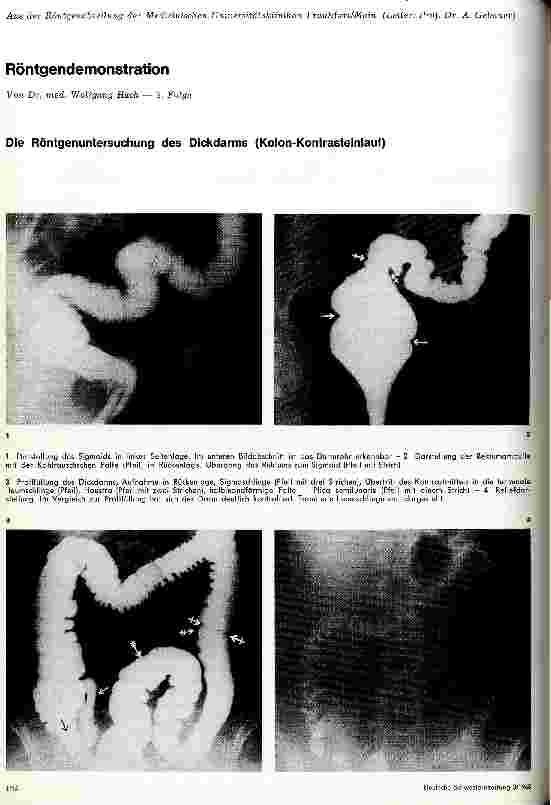 Vorschauseite 1: Röntgendemonstration 2. Folge: Die Röntgenuntersuchung des Dickdarms