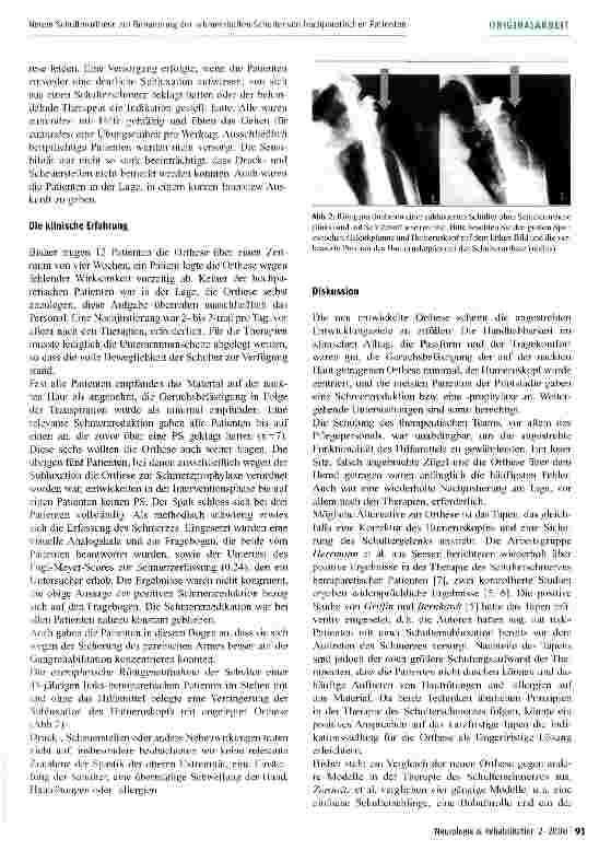 Vorschauseite 3: Vorstellung einer neuen Schulterorthese zur Behandung der schmerzhaften Schulter von hochparetischen Patienten in der Frührehabilitation