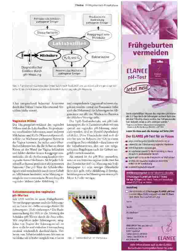 Vorschauseite 2: Frühgeburten und späten Fehlgeburten vorbeugen