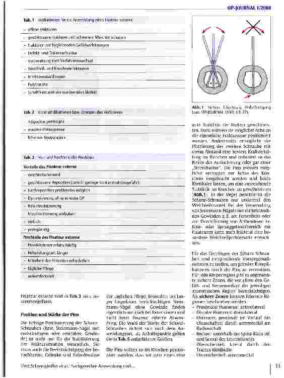 Vorschauseite 2: Sachgerechte Anwendung und Komplikationsmanagement beim Fixateur externe