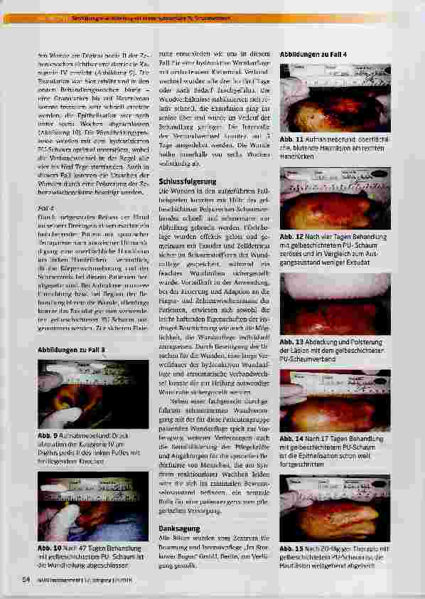 Vorschauseite 4: Beschleunigte Wundheilung mit einem hydroaktiven PU-Schaumverband: Beispiele aus der Langzeitrehablilitation