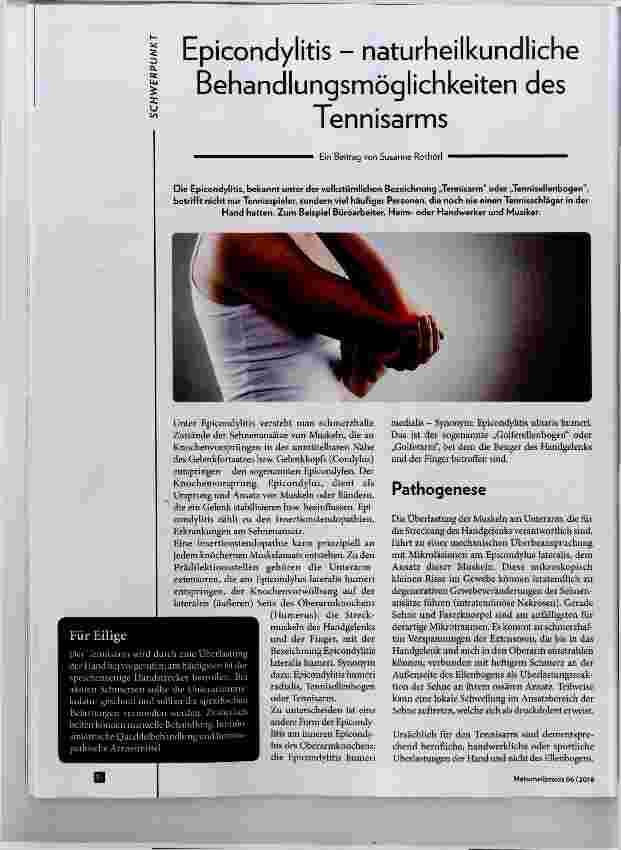 Vorschauseite 1: Epicondylitis naturheilkundliche Behandlungsmöglichkeiten des Tennisarms