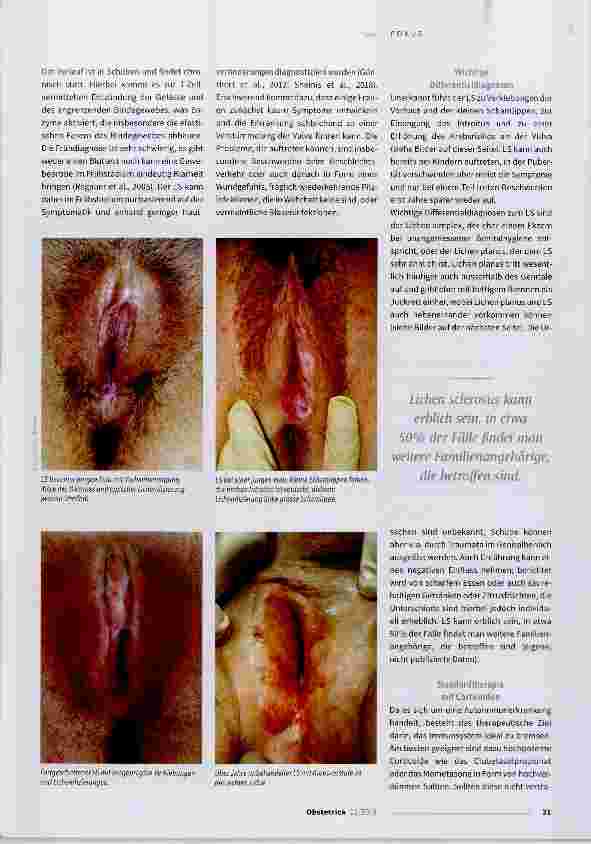 Vorschauseite 2: Wenn die Vulva juckt und brennt