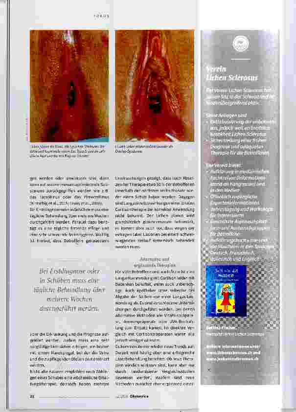 Vorschauseite 3: Wenn die Vulva juckt und brennt