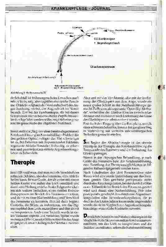 Vorschauseite 3: Ursachen, Klinik und Therapie der Netzhautablösung