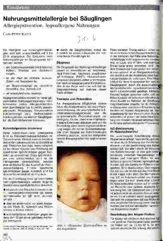 Vorschauseite 1: Nahrungmittelallergie bei Säuglingen Allergieprävention, hypoallergene Nahrungen