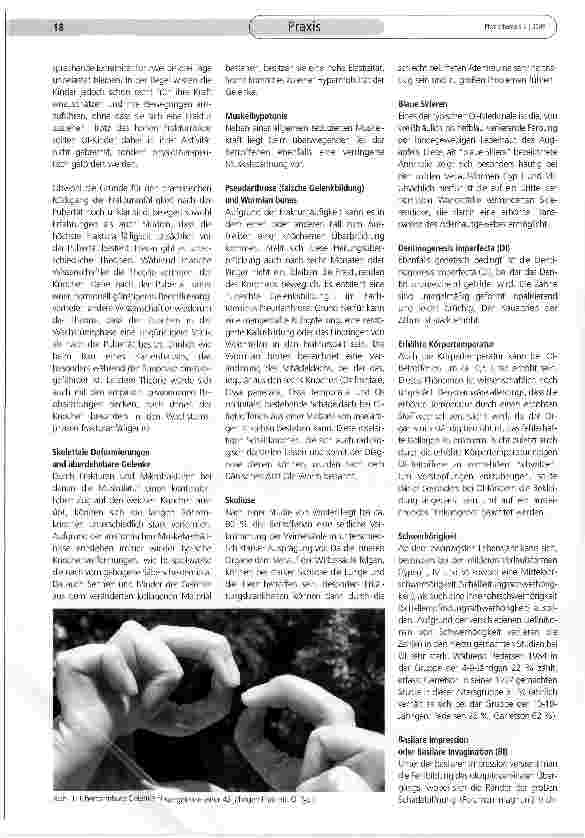 Vorschauseite 2: Osteogenesis imperfecta als physiotherapeutische Herausforderung? Teil (II)