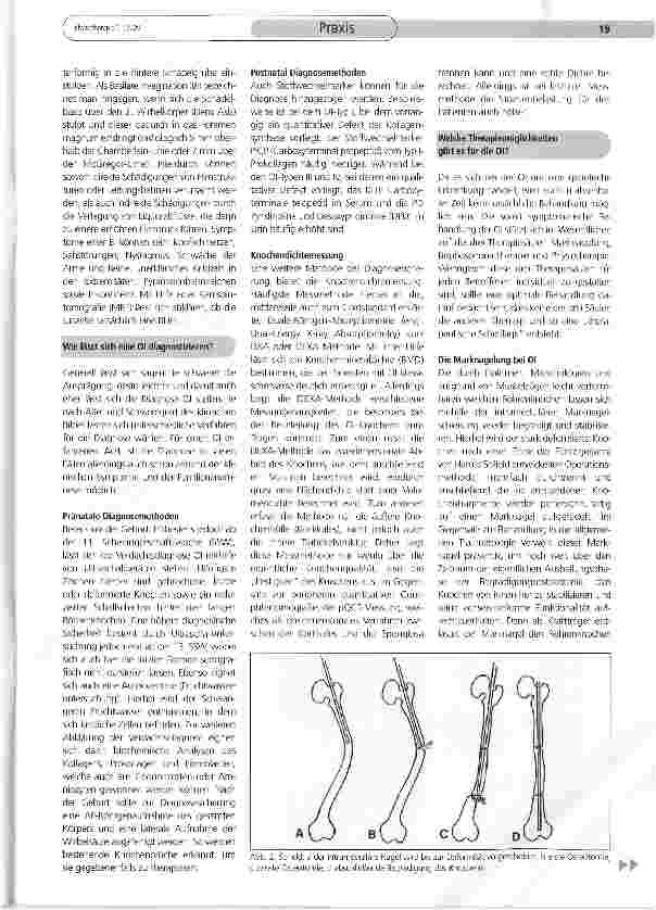 Vorschauseite 3: Osteogenesis imperfecta als physiotherapeutische Herausforderung? Teil (II)