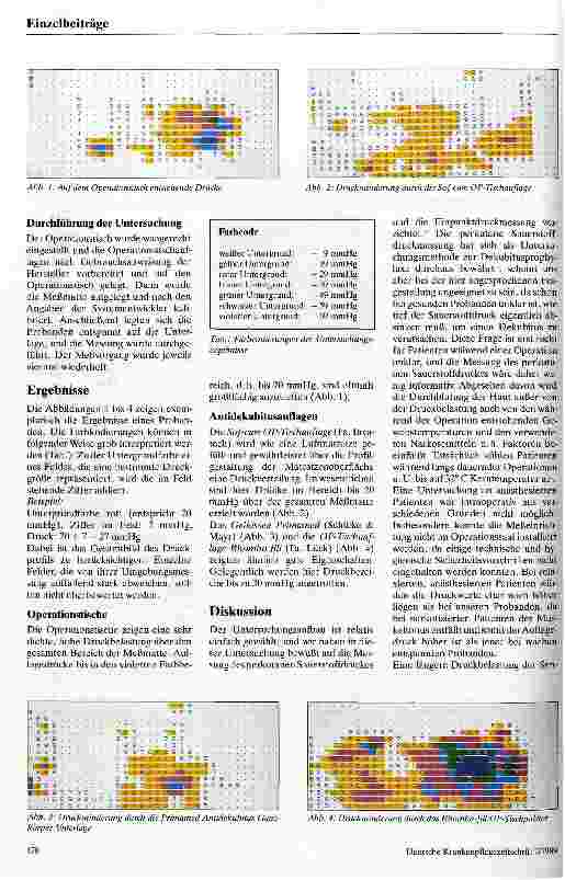 Vorschauseite 2: Dekubitusprophylaxe im Operationssaal Untersuchung zum Aulagedruck bei Probanden auf Operationstischen
