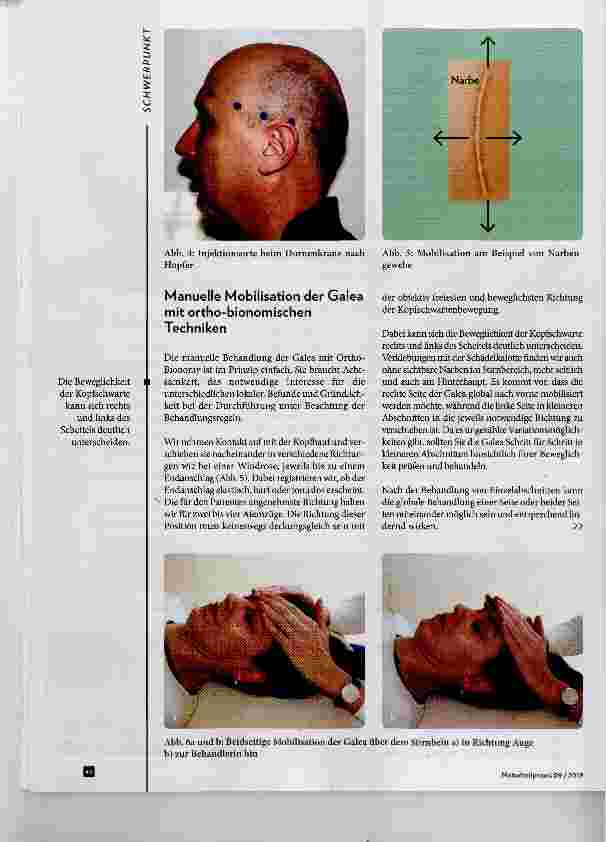 Vorschauseite 3: Die Kopfhaut