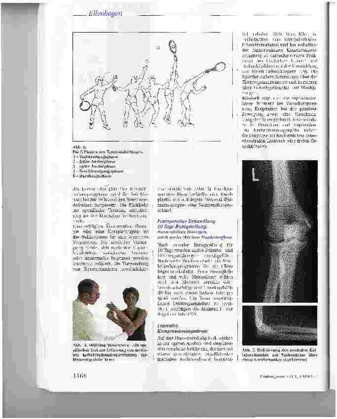 Vorschauseite 6: Sportverletzungen des Ellenbogengelenks