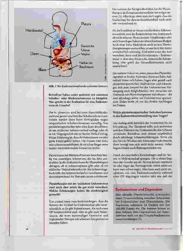 Vorschauseite 3: Therapie bei Endometriose