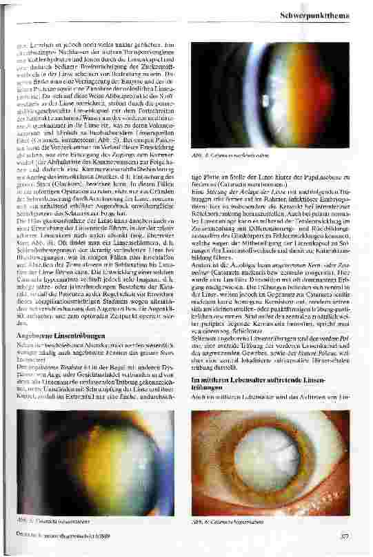 Vorschauseite 3: Der graue Star