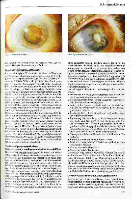 Vorschauseite 5: Der graue Star