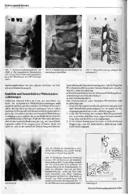 Vorschauseite 3: Wirbelsäulenverletzungen