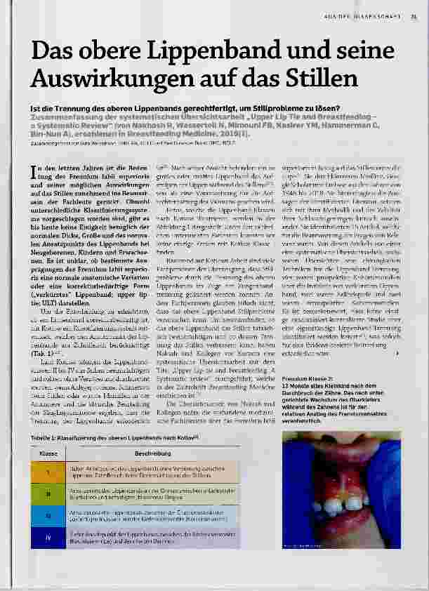 Vorschauseite 1: Das obere Lippenband und seine Auswirkungen auf das Stillen