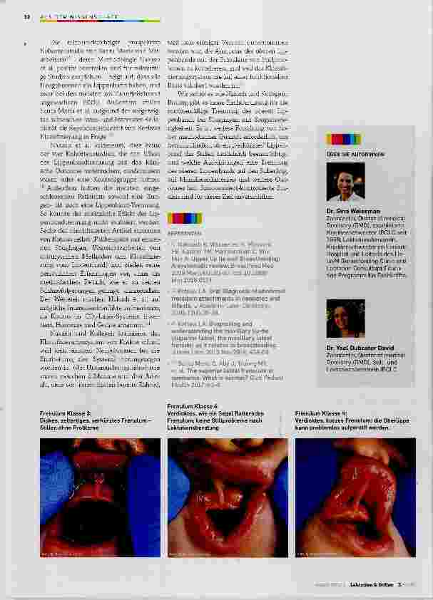 Vorschauseite 2: Das obere Lippenband und seine Auswirkungen auf das Stillen