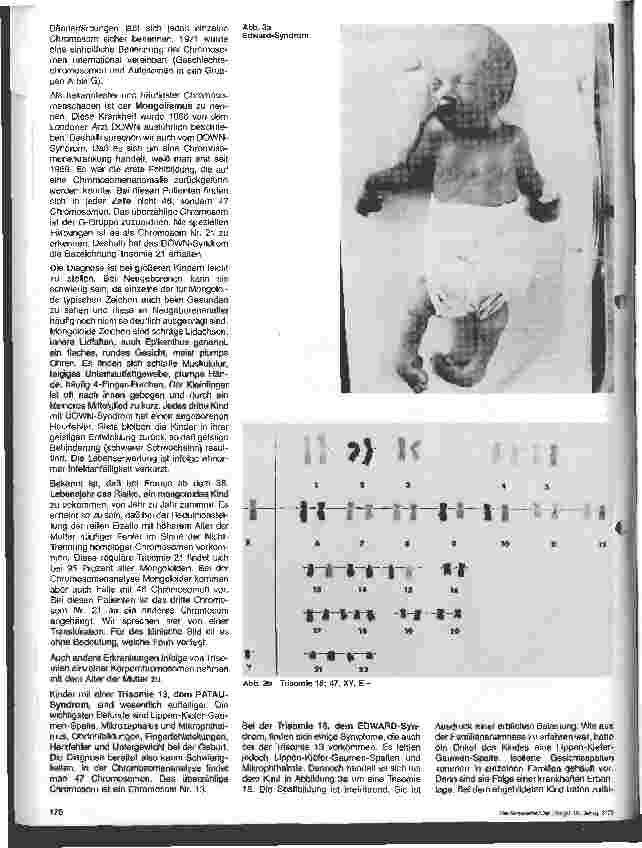 Vorschauseite 2: Chromosomenanomalien bei Kindern