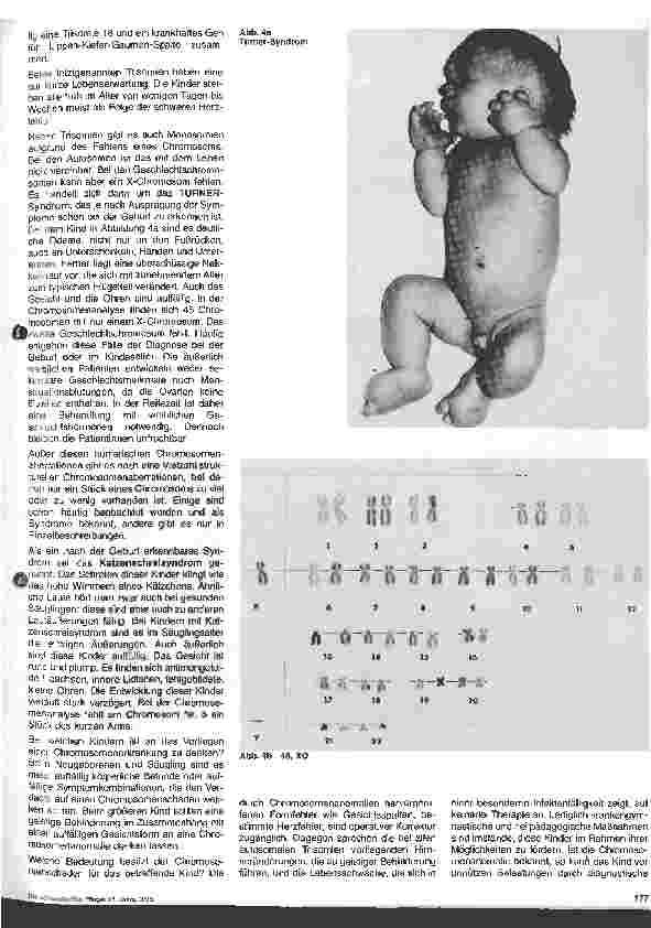 Vorschauseite 3: Chromosomenanomalien bei Kindern