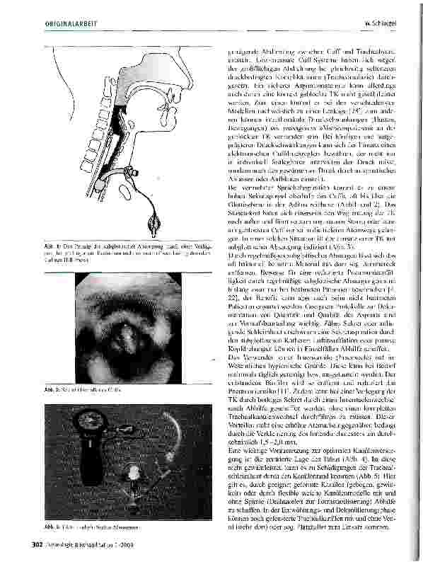 Vorschauseite 2: Das Trachealkanülenmanagement in der neurologischen Rehabilitation