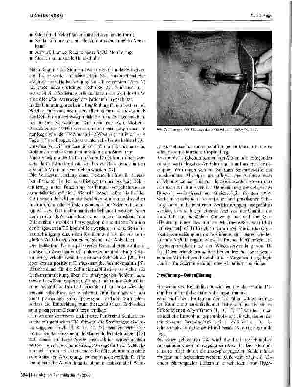Vorschauseite 4: Das Trachealkanülenmanagement in der neurologischen Rehabilitation