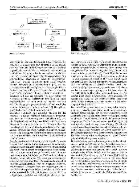 Vorschauseite 5: Das Trachealkanülenmanagement in der neurologischen Rehabilitation