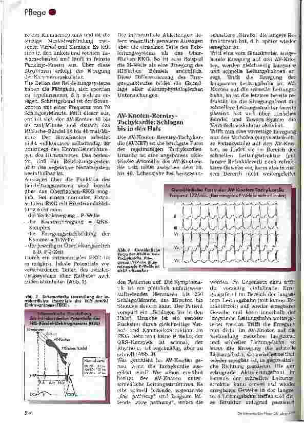 Vorschauseite 3: Katheterablation und elektrophysiologische Untersuchung bei Herzrhytmusstörung