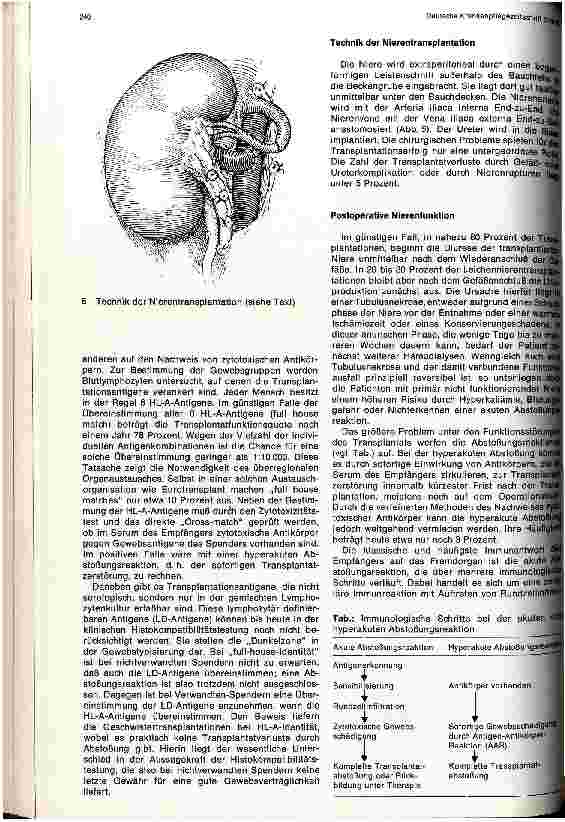 Vorschauseite 4: Fortschritte der Transplantationschirurgie