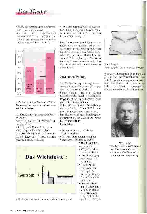 Vorschauseite 2: Stomamarkierung Wie zuverlässig sind sogenannte Daumenregeln?