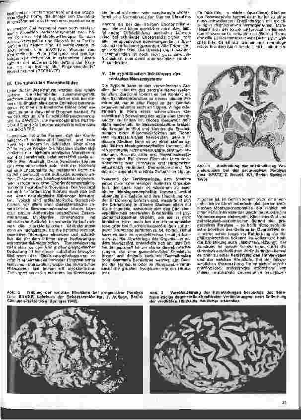 Vorschauseite 2: Die Schwester in der Psychiatrie 20. Folge: Psychiatrische Aspekte entzündlicher Erkrankungen des ZNS