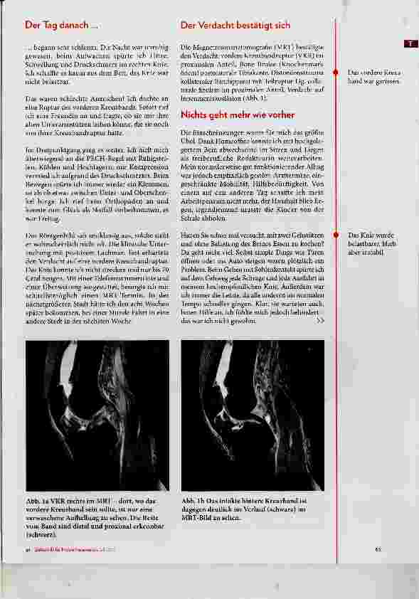 Vorschauseite 2: Nächster Knie-Patient: Physiotherapeutin! Teil 1: Vordere Kreuzbandruptur beim Sport