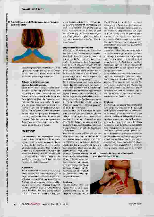 Vorschauseite 3: Kinesio Tape in der Logopädie ein Überblick